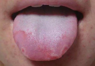 2023宜賓自體脂肪填充眼窩正規(guī)專家推薦前10位(尤軍、詹清、王喬干貨帖收藏)