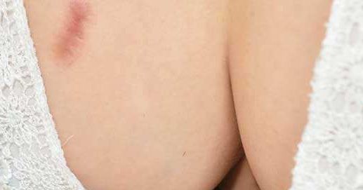 山東小陰唇手術(shù)哪家正規(guī)專業(yè)值得選擇？