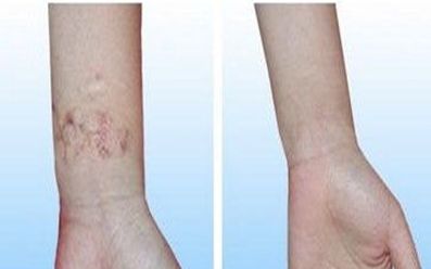 濟寧去雀斑醫(yī)院哪家好？揭秘濟寧市治療雀斑效果最好的醫(yī)院