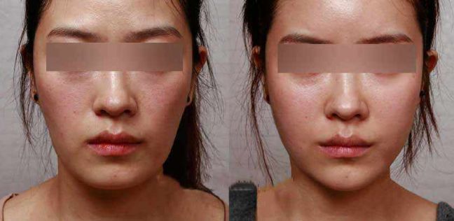 青島水光針推薦醫(yī)院排行榜：哪家醫(yī)院好？