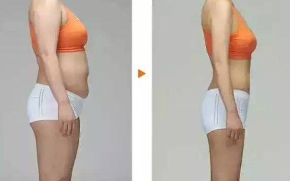 深圳哪家醫(yī)院能夠優(yōu)質(zhì)完成正頜手術(shù)？