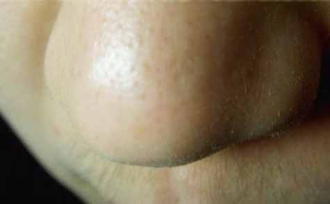 2023石家莊面部年輕化手術(shù)醫(yī)生前十名排行(李海霞、郭立亞、李輝實力派，放心選！)