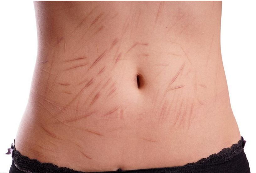 南京抽脂手術(shù)那家醫(yī)院技術(shù)靠譜？哪家醫(yī)院的抽脂效果好？