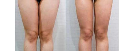 2023年河南省私密醫(yī)院排名及專家推薦：了解河南省私密醫(yī)院哪家好