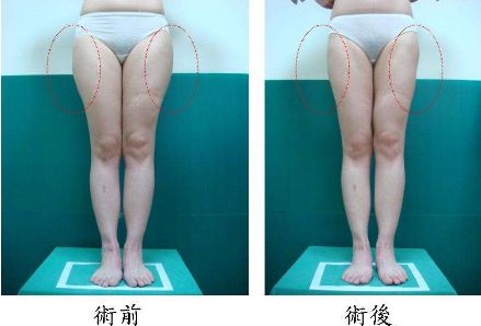 昆明哪家治痘痘好的醫(yī)院，痘痘問題如何有效解決？