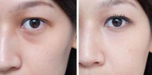 武漢看胎記醫(yī)院哪家好？綜合醫(yī)療機(jī)構(gòu)排行榜詳細(xì)解讀