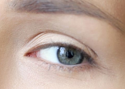 2023孝感美白導(dǎo)入醫(yī)生上榜前十名(嚴飛、楊白蘭、鄧昵實力靠譜口碑佳)