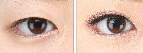 上海哪家醫(yī)院做處女膜修復好？