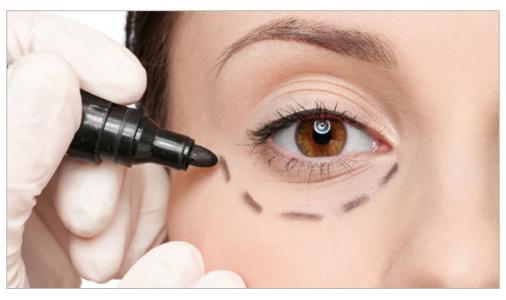 鄭州五位眼修復(fù)整形專家排行榜出爐！助您輕松選擇