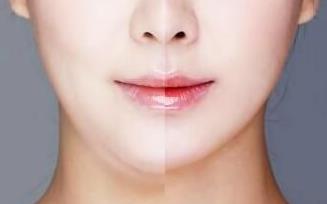 2023湖南切開法去眼袋正規(guī)醫(yī)生10強(qiáng)(肖調(diào)立、張雪梅、趙茜口碑up！)