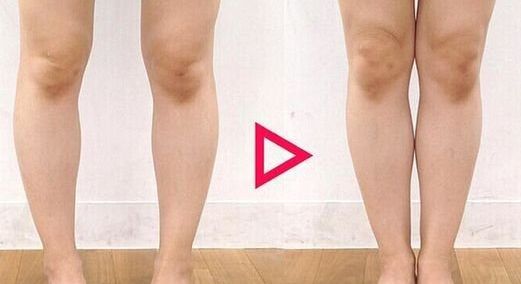 南昌二附院整形科腰腹吸脂是否可靠？醫(yī)生專業(yè)解讀幫您解答