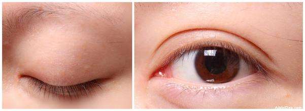 2023昆明隔空溶脂瘦肩部醫(yī)生top10強(qiáng)排名(李明、唐欽、任德浩榜首屬實(shí)意外)