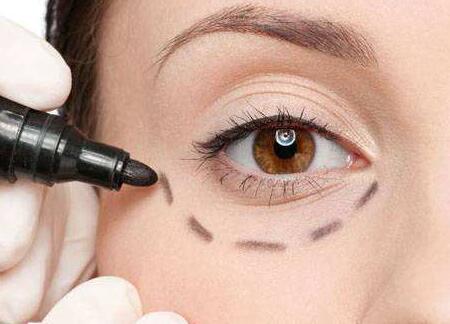 蘇州哪位醫(yī)生修復(fù)雙眼皮失敗靠譜？案例分享有人氣！