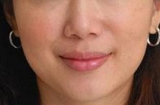 2023鄭州面部綜合化抗衰前10強專家(郭丹、李林、季亞利實力口碑都很牛)