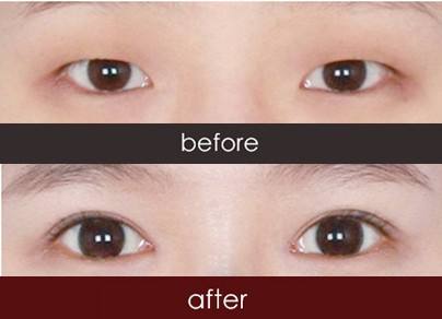 2023濟(jì)寧激光除眼底紋權(quán)威專(zhuān)家評(píng)價(jià)TOP10強(qiáng)(郝昭華、宋成、李華榜前三毫無(wú)懸念)