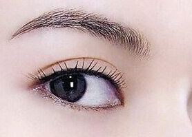 南充去眼袋哪家醫(yī)院好？專家推薦解決眼袋困擾的南充醫(yī)院排行榜