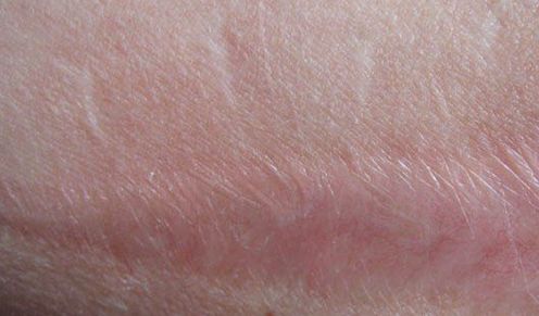 嘉興有哪些專業(yè)的醫(yī)美機構(gòu)提供雙眼皮手術(shù)？