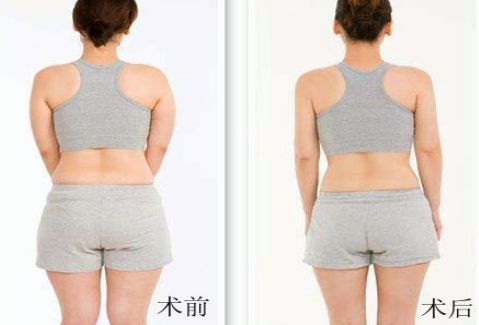 洛陽雙眼皮好的醫(yī)院有哪些？