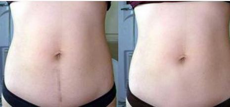 成都眼袋整形醫(yī)院哪家好？選擇專業(yè)整形醫(yī)院護(hù)你年輕無(wú)眼袋