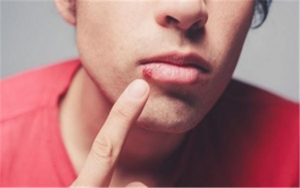 2023石家莊做c8激光祛斑口碑榜前十位的醫(yī)生(王鵬、張鴻超、張暖都是人氣醫(yī)美top)