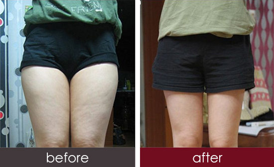 2023嘉興點(diǎn)陣激光對(duì)色素沉著專家前十(朱若寧、周宗立、楊連華專業(yè)實(shí)力深受信賴！)