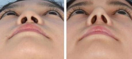 衢州做小手術哪家醫(yī)院好？快速推薦衢州當?shù)貙I(yè)的醫(yī)院