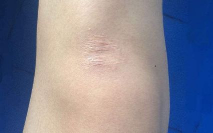 ?？诔暼パ鄞罴堰x擇有哪些？評價最好的醫(yī)療機構(gòu)大揭秘！