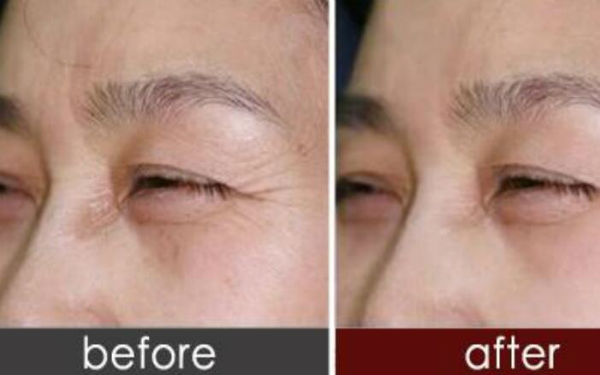 上海肋骨鼻哪位專家技術(shù)過硬？人氣牛仔鼻醫(yī)生排名大曝光！