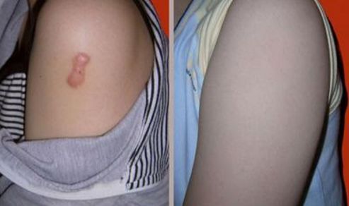 長(zhǎng)春整形醫(yī)院哪家好？排名靠前的長(zhǎng)春市好的整形醫(yī)院推薦