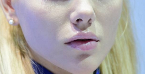 2023烏魯木齊肚子射頻溶脂在榜名單前十位醫(yī)生(劉艷、洪喬茵、張弘業(yè)讓整形更有保障)