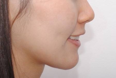 上海綜合醫(yī)院的拉皮醫(yī)生詳細(xì)介紹