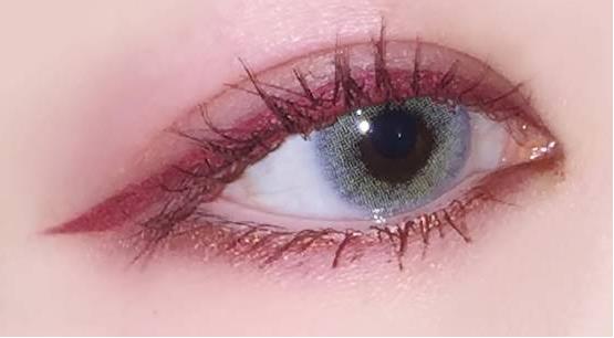 合肥非常靠譜的毛發(fā)醫(yī)院，劉維醫(yī)生大面積植發(fā)1年后結果驚艷！