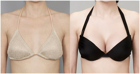 上海杜園園-專業(yè)修復(fù)雙眼皮，眼整形教授強(qiáng)勢(shì)推薦！附案例，讓您放心選擇！