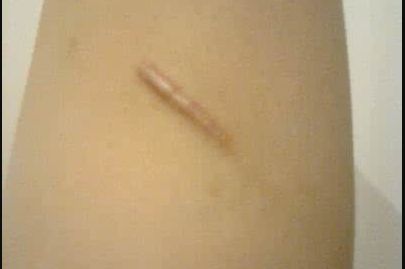 濟寧哪家做假體隆胸好？揭秘濟寧最受歡迎的假體隆胸醫(yī)院！