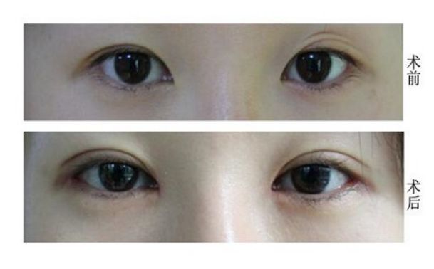 天津修復(fù)唇腭裂的醫(yī)院哪家好？專業(yè)解讀！