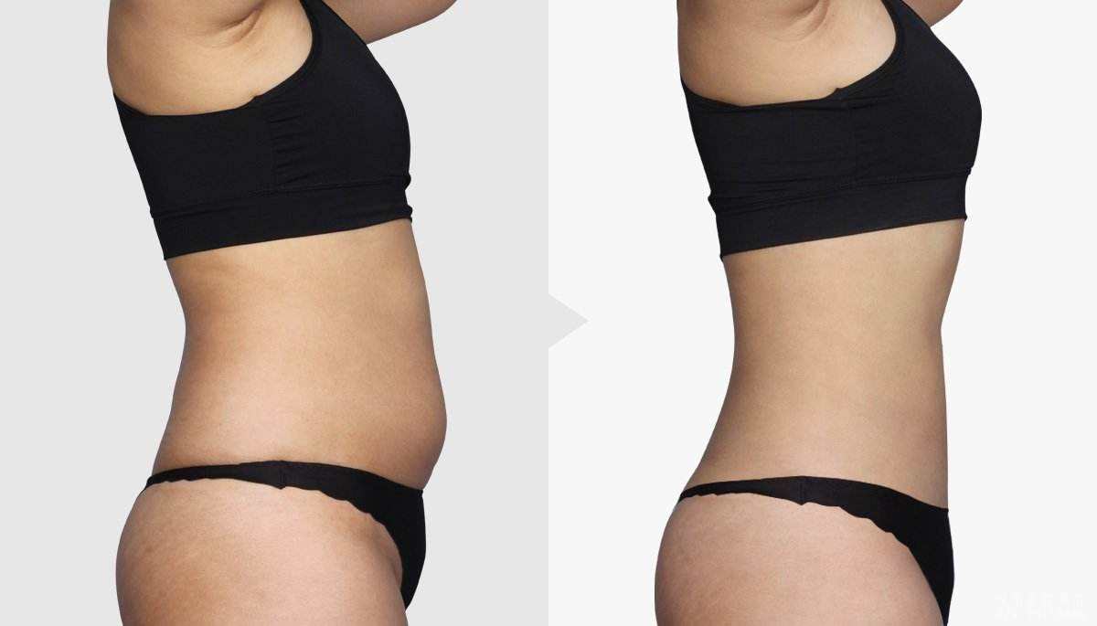 2023杭州手術除黑痣正規(guī)醫(yī)生排行榜前10名(林萍、鄭曉飛、彭濤口碑好，放心選！)