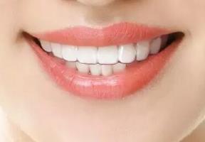 2023紹興法令紋去除法專家排名top10強(qiáng)(李飛、鞏憶、譚成林網(wǎng)友親測好評(píng)名單分享！)