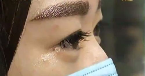 武漢招風(fēng)耳矯正哪家好？尋找專業(yè)耳部矯正專家的最佳選擇