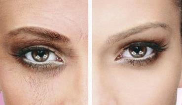 2023貴州靜態(tài)紋手術(shù)祛除權(quán)威專家排行前十強(qiáng)(胡紹洪、張媛、孫超這些專家名單看到就是賺到)