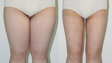 長春治療雀斑哪家醫(yī)院好？雀斑治療哪家醫(yī)院比較靠譜呢？