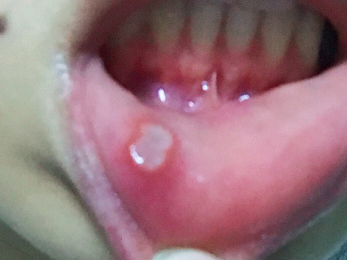 2023南昌激光鐳射祛雀斑正規(guī)專家評價(jià)前10位(胡秀龍、胡建、滿雪評價(jià)值得看)