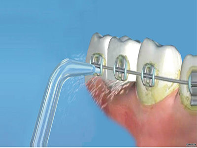 2023大連針雕祛除口周紋排名前幾的專家(孫妍娜、楊曉英、王殿峰價格不貴還親民)