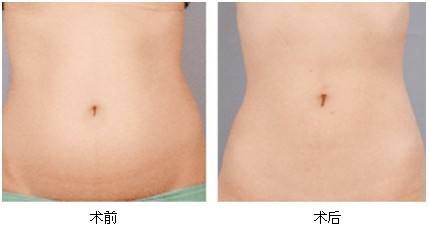 2023東莞激光磨皮除皺推薦十強專家(王麗沙、朱曉梅、黃雙聞入圍的都是當?shù)蒯t(yī)美領頭羊)