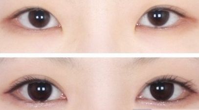 ?？谧雎”轻t(yī)院哪家好？?？谀募艺葆t(yī)院的鼻部整形效果好且口碑贊？