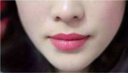 2023東莞膠原蛋白豐耳榜單前十名專(zhuān)家(劉潤(rùn)貴、馬昌華、王立剛都是正規(guī)好口碑的)