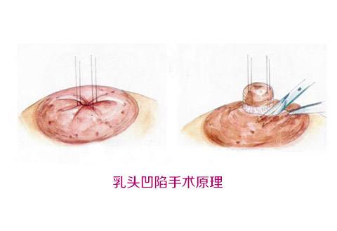 揭秘北京大學(xué)深圳醫(yī)院整形外科名醫(yī)團隊！想了解吸脂案例嗎？來看這里！