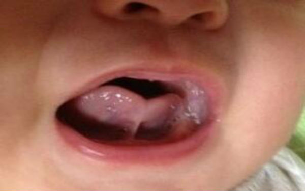 2023廣安光波祛雀斑top10強(qiáng)的醫(yī)生(朱鴷、蔣朝華、蔣朝華真實(shí)口碑橫評(píng)分享)