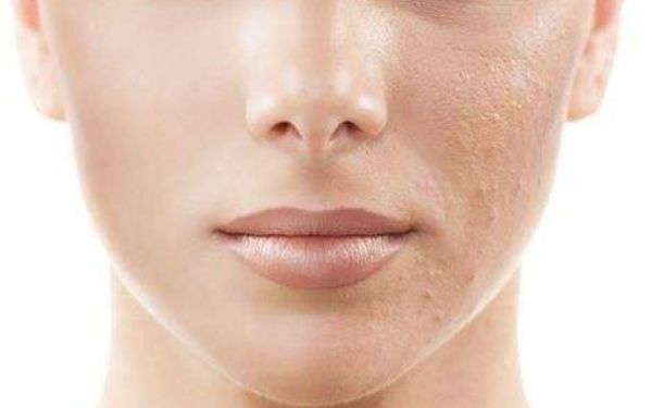 上海柴云做雙眼皮修復(fù)是否靠譜？體驗(yàn)如何？