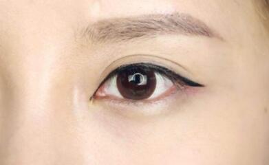 上海九院美容科的專家揭秘！魏皎、張余光、韋敏醫(yī)生值得信賴嗎？附磨顴骨體驗(yàn)分享