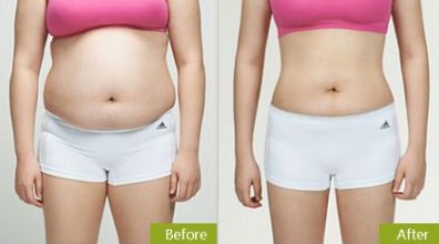 合肥祛眼袋，如何選擇最適合的醫(yī)院？